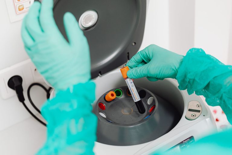 Lyon : Ce test révolutionnaire de BioMérieux pourrait sauver des vies en détectant les infarctus rapidement